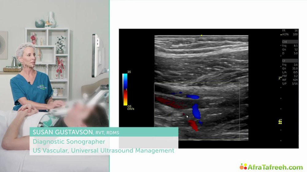 Preview image for 123sonography atf