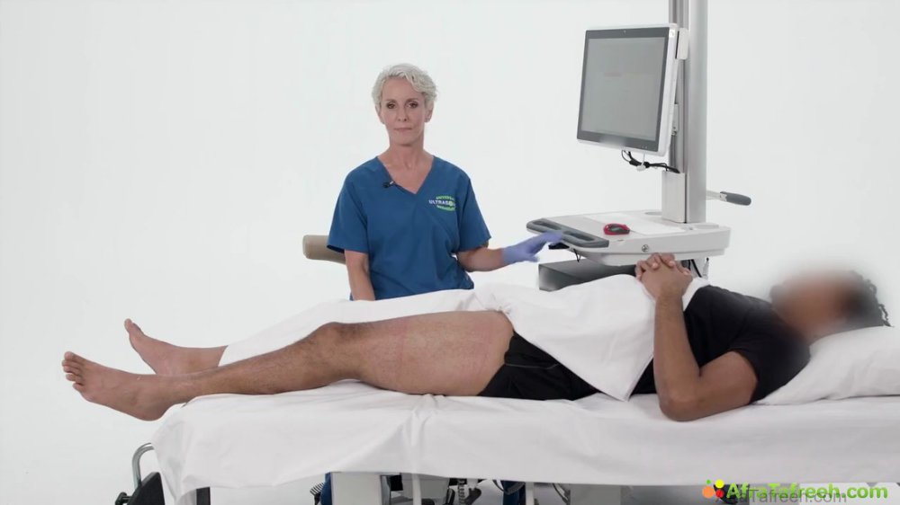 Preview image for 123sonography atf