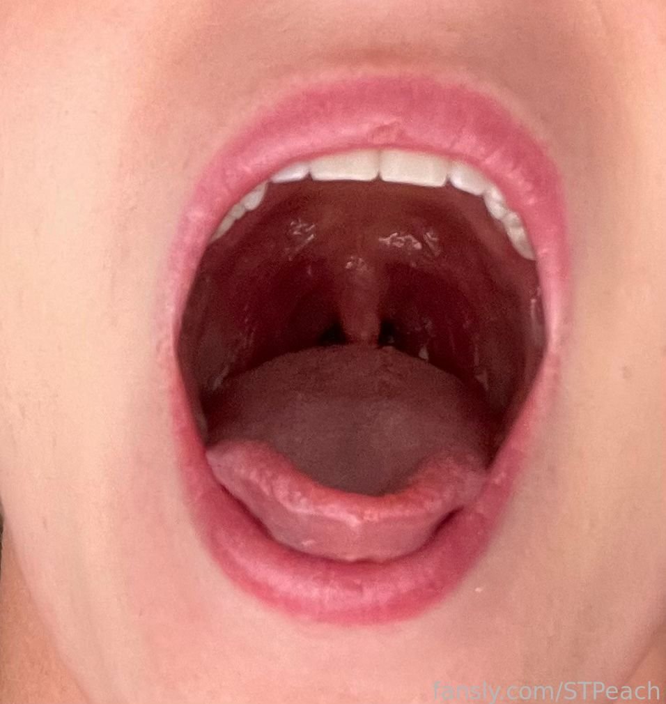 Preview image for stpeach