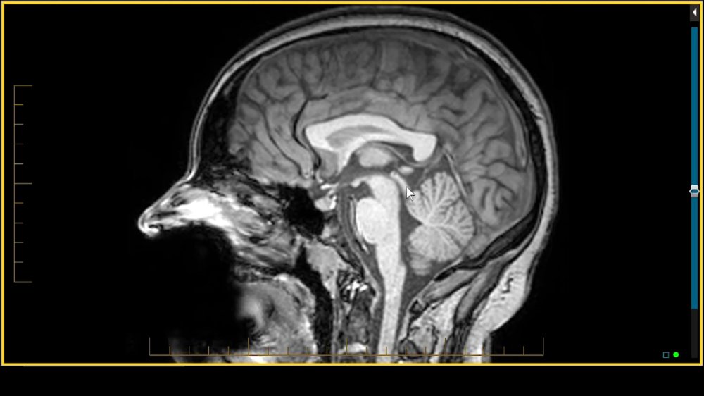 Preview image for mri_online 