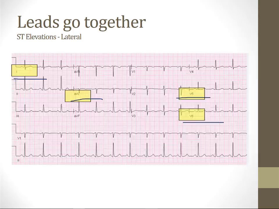 Preview image for boards and beyond