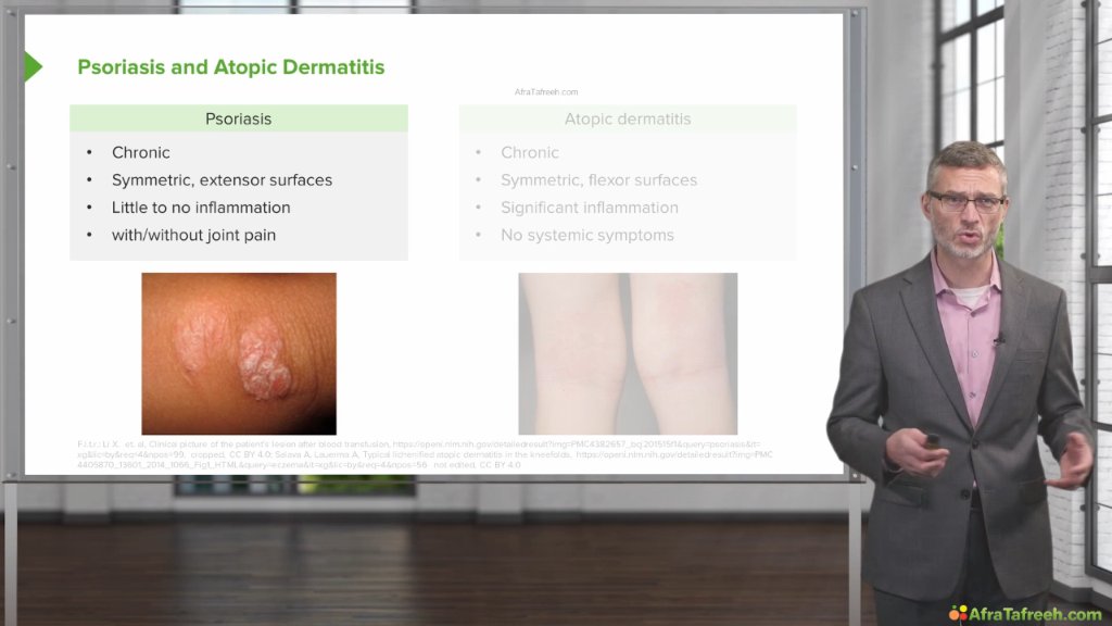 Preview image for physical examination - lecturio
